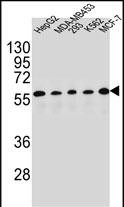 Rabbit Polyclonal Antibody to PAX1