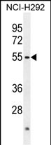 Rabbit Polyclonal Antibody to ACTL7A (N-term)