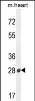 Rabbit Polyclonal Antibody to B3GAT2