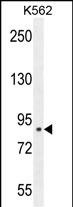 Rabbit Polyclonal Antibody to CLIC6