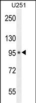 Rabbit Polyclonal Antibody to MICALL1