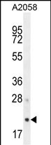 Rabbit Polyclonal Antibody to AP3S1 (N-term)