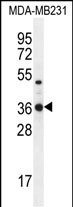 Rabbit Polyclonal Antibody to TPSD1