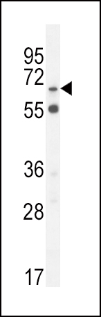 Rabbit Polyclonal Antibody to S6A12 (N-term)