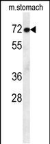 Rabbit Polyclonal Antibody to MCAF2