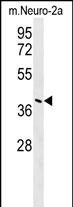 Rabbit Polyclonal Antibody to CASC4  (C-term)