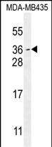 Rabbit Polyclonal Antibody to MYCT1  (C-term)