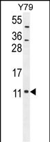 Rabbit Polyclonal Antibody to NDUAB