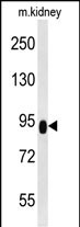 Rabbit Polyclonal Antibody to ZBTB41