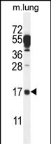 Rabbit Polyclonal Antibody to C14orf126