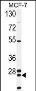 Rabbit Polyclonal Antibody to NUDT8 (N-term)
