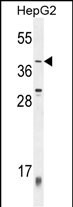 Rabbit Polyclonal Antibody to ZNF763