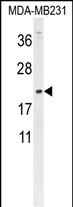 Rabbit Polyclonal Antibody to DMRTC1 (N-term)