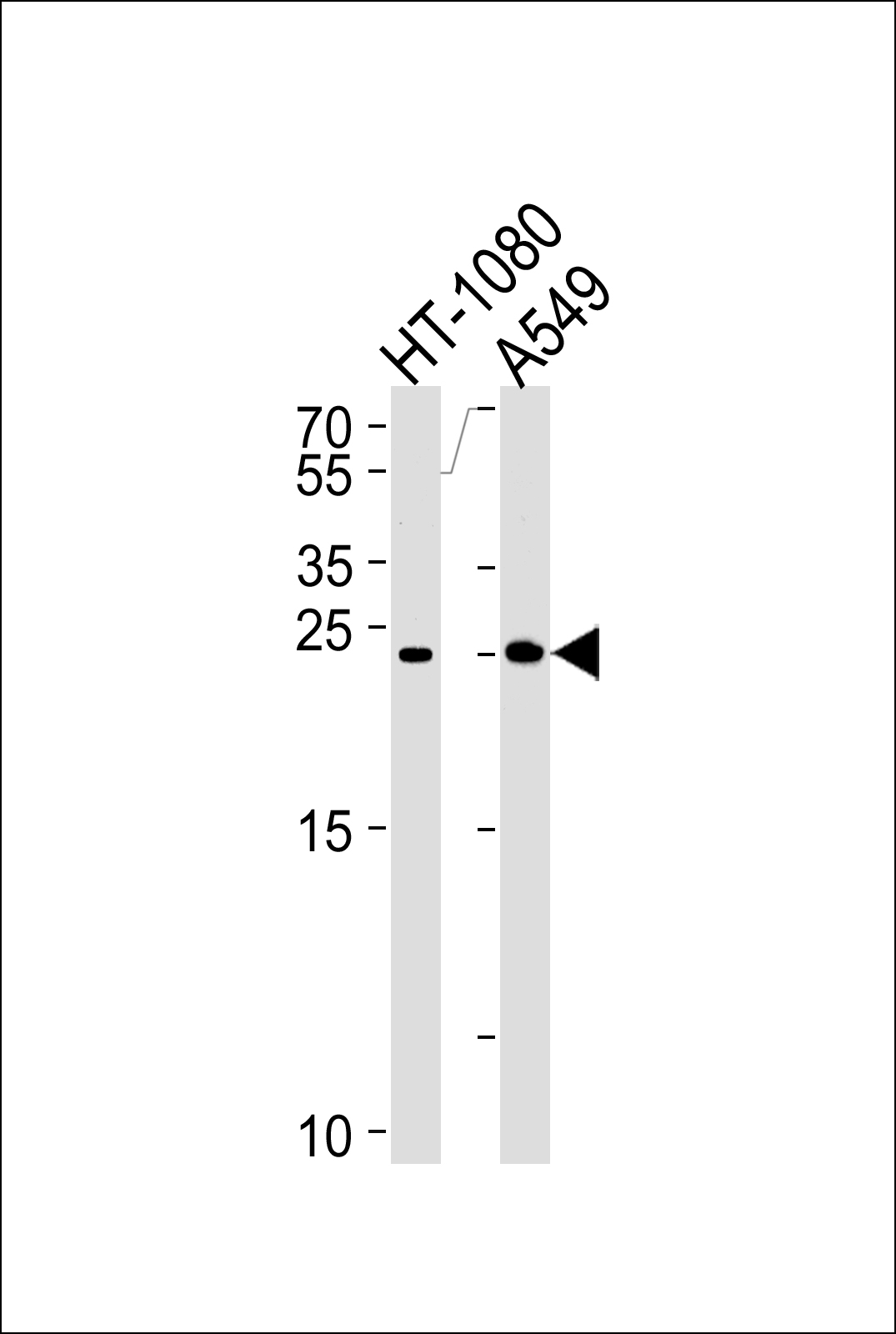 Rabbit Polyclonal Antibody to JOSD2 (N-term)