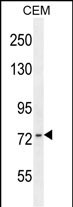 Rabbit Polyclonal Antibody to ZNF493