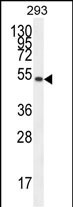 Rabbit Polyclonal Antibody to IGSF5 (N-term)
