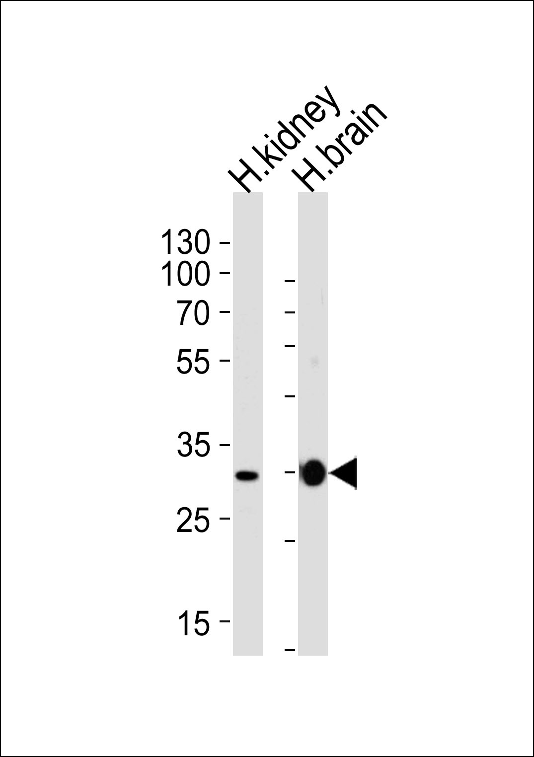 Rabbit Polyclonal Antibody to PRRG3