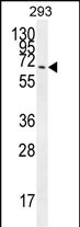 Rabbit Polyclonal Antibody to CCDC37 (N-term)
