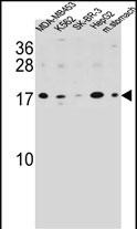 Rabbit Polyclonal Antibody to S100Z (N-term)