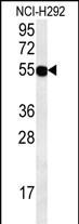 Rabbit Polyclonal Antibody to ZNF492