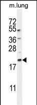 Rabbit Polyclonal Antibody to APG8a/b(MAP1LC3A/B)