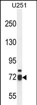 Rabbit Polyclonal Antibody to WDR76