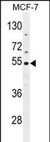 Rabbit Polyclonal Antibody to CES2