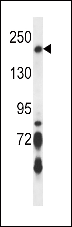 Rabbit Polyclonal Antibody to BRIP1 (N-term)