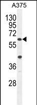 Rabbit Polyclonal Antibody to ACF