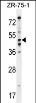 Rabbit Polyclonal Antibody to PDE7B