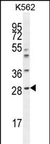 Rabbit Polyclonal Antibody to APCS