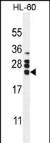 Rabbit Polyclonal Antibody to CSF2