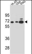 Rabbit Polyclonal Antibody to AMY2B (N-term)