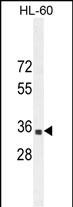 Rabbit Polyclonal Antibody to B3GNT4