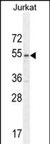 Rabbit Polyclonal Antibody to MPP1