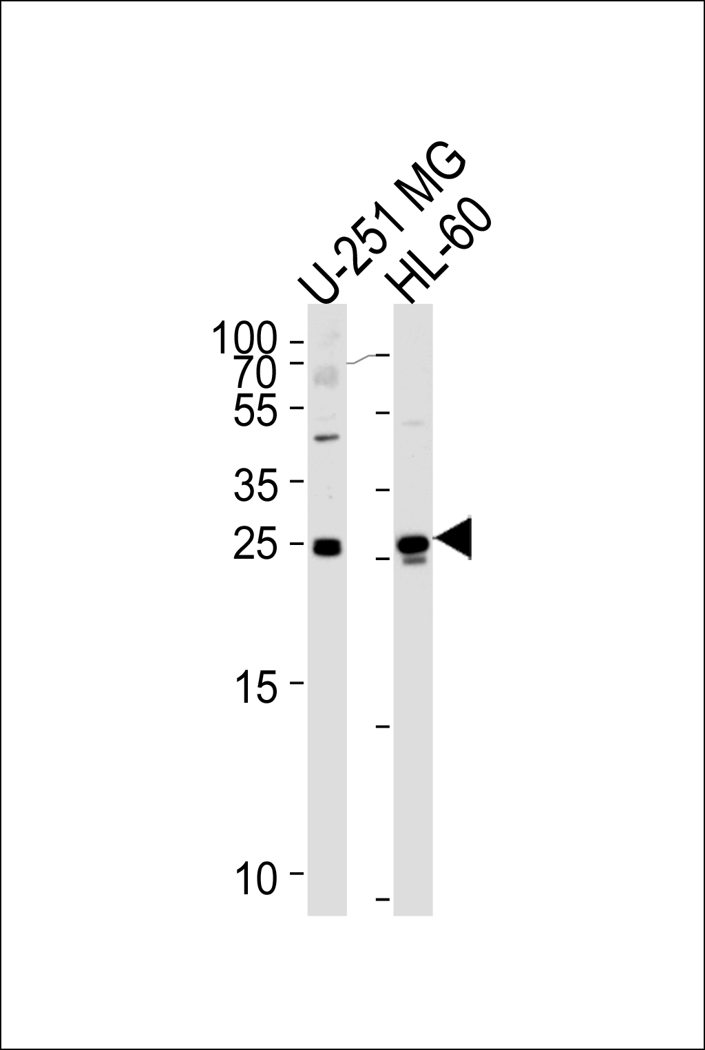 Rabbit Polyclonal Antibody to WIBG (N-term)