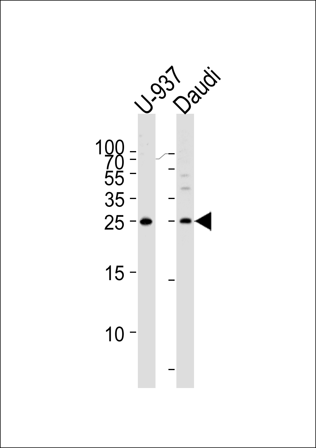 Rabbit Polyclonal Antibody to CD37