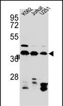 Rabbit Polyclonal Antibody to HNRNPC