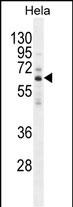 Rabbit Polyclonal Antibody to HYAL2