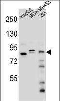Rabbit Polyclonal Antibody to KIAA1310