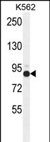 Rabbit Polyclonal Antibody to ZNF366