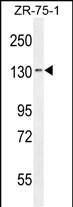 Rabbit Polyclonal Antibody to TLL1