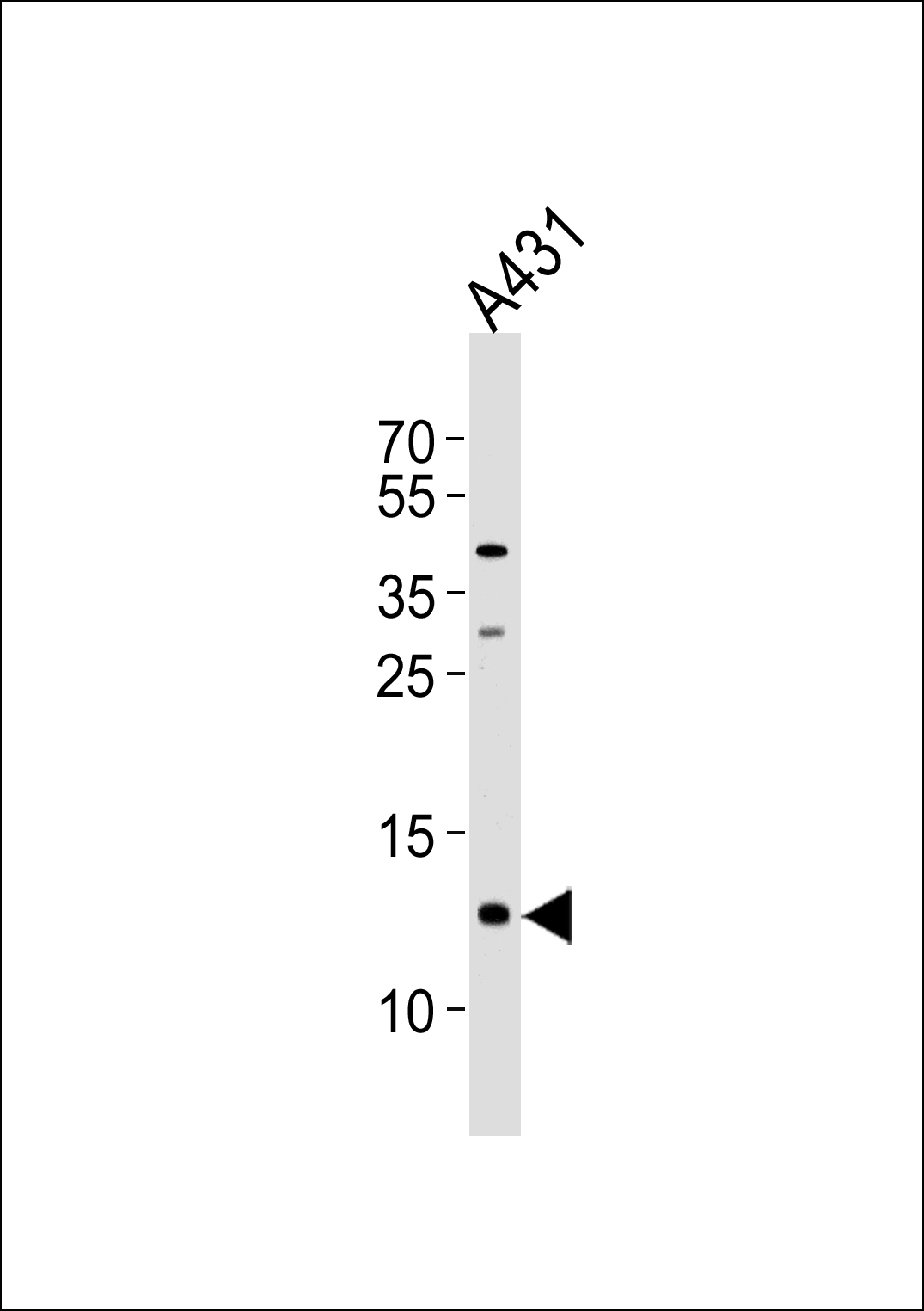 Rabbit Polyclonal Antibody to SPRR2A
