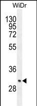 Rabbit Polyclonal Antibody to ZC4H2