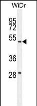 Rabbit Polyclonal Antibody to RT4I1  (C-term)