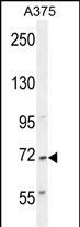 Rabbit Polyclonal Antibody to AL2SA  (N-term)
