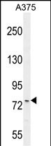 Rabbit Polyclonal Antibody to ANR44