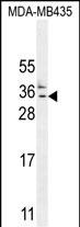 Rabbit Polyclonal Antibody to CK073  (N-term)