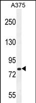 Rabbit Polyclonal Antibody to CB086  (C-term)