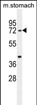 Rabbit Polyclonal Antibody to SRAC1  (C-term)